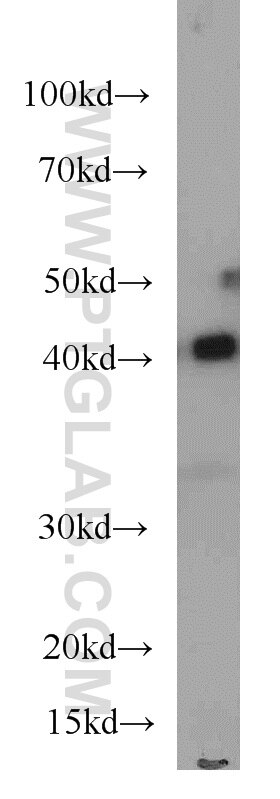 WB analysis of HeLa using 66036-1-Ig