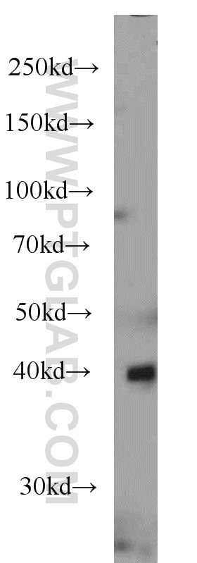 Western Blot (WB) analysis of human liver tissue using ASS1 Monoclonal antibody (66036-1-Ig)