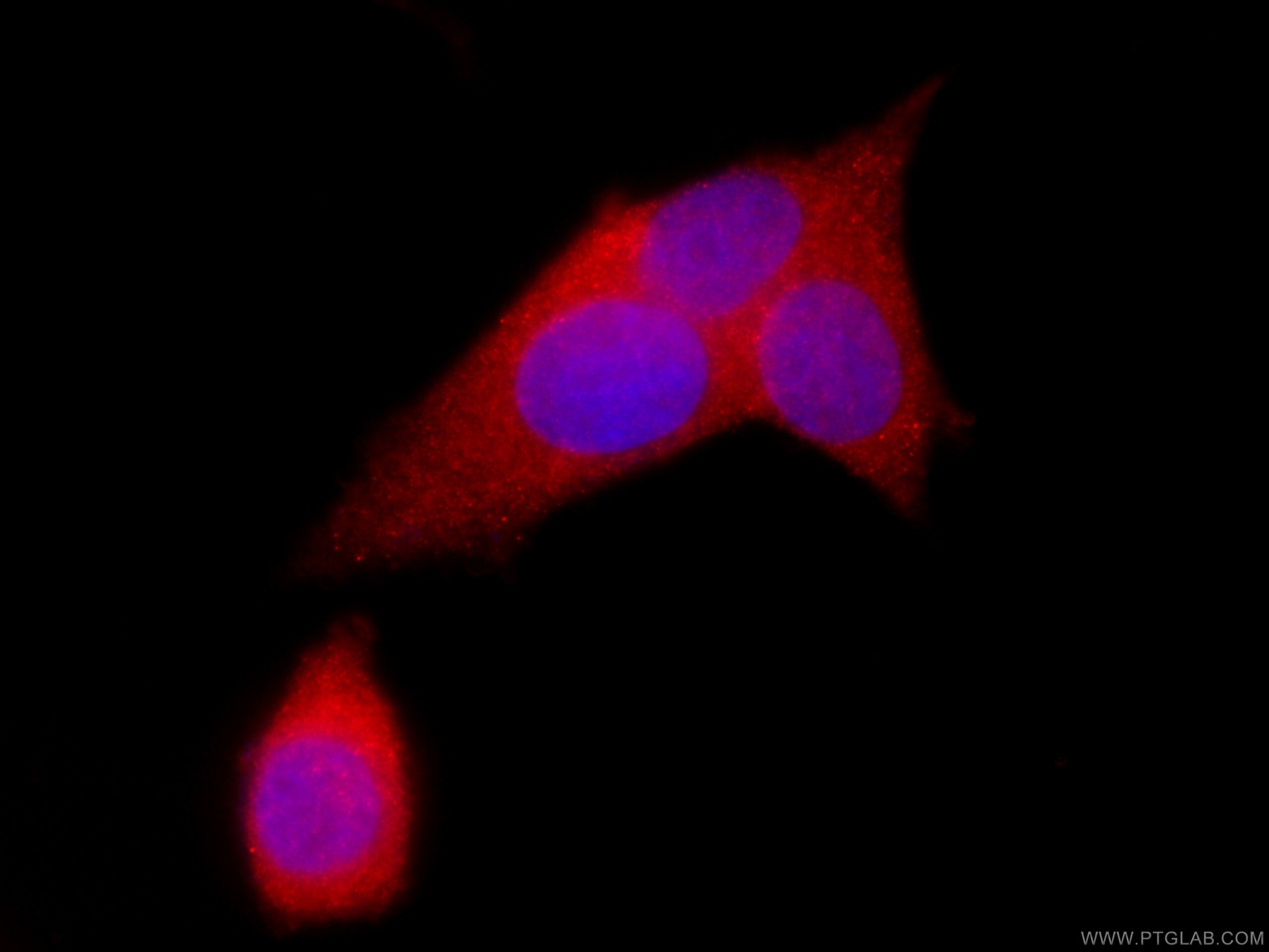 IF Staining of MCF-7 using CL594-66036