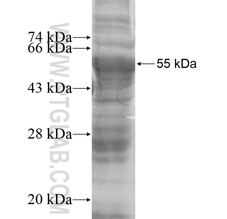 ASS1 fusion protein Ag9200 SDS-PAGE