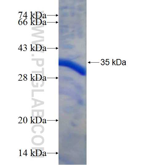 ASS1 fusion protein Ag9314 SDS-PAGE