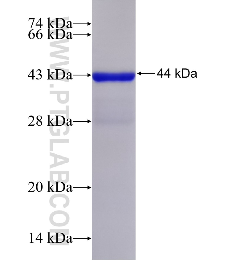 ASTE1 fusion protein Ag32339 SDS-PAGE ASTE1 fusion protein Ag32339 SDS-PAGE