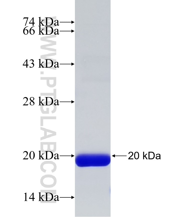ASTE1 fusion protein Ag32354 SDS-PAGE ASTE1 fusion protein Ag32354 SDS-PAGE