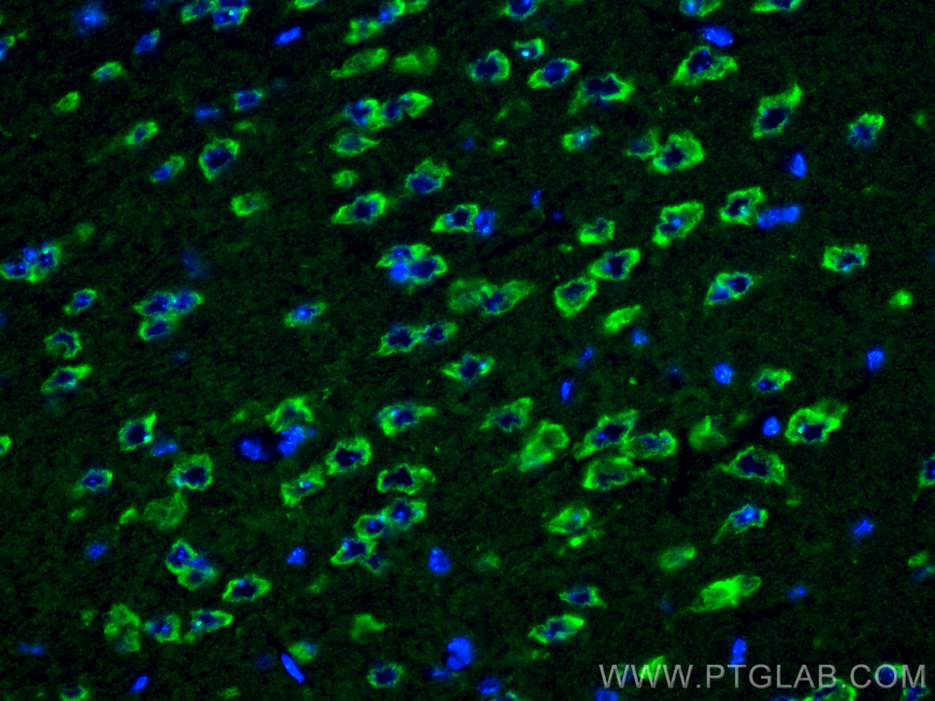 Immunofluorescent analysis of (4% PFA) fixed paraffin-embedded mouse brain tissue using ASTN1 antibody (21267-1-AP) at dilution of 1:400 and CoraLite®488-Conjugated Goat Anti-Rabbit IgG(H+L) (SA00013-2). Heat mediated antigen retrieval with Tris-EDTA buffer (pH 9.0). Immunofluorescence (IF) / fluorescent staining of mouse brain tissue using ASTN1 Polyclonal antibody (21267-1-AP)