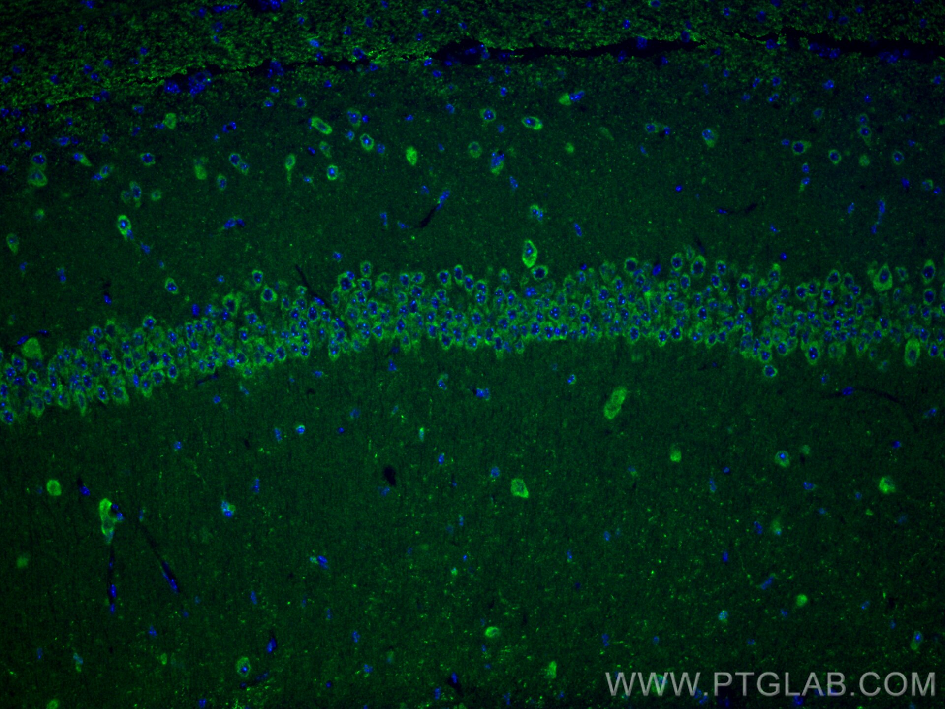 Immunofluorescent analysis of (4% PFA) fixed paraffin-embedded mouse brain tissue using ASTN1 antibody (21267-1-AP) at dilution of 1:200 and CoraLite®488-Conjugated Goat Anti-Rabbit IgG(H+L) (SA00013-2). Heat mediated antigen retrieval with Tris-EDTA buffer (pH 9.0). Immunofluorescence (IF) / fluorescent staining of mouse brain tissue using ASTN1 Polyclonal antibody (21267-1-AP)