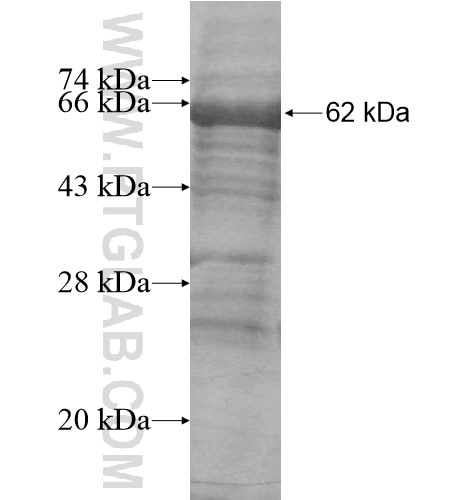 ASTN1 fusion protein Ag15731 SDS-PAGE
