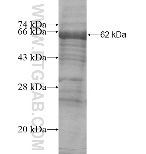 ASTN1 fusion protein Ag15731 SDS-PAGE