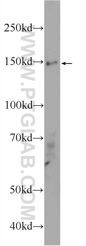 Western Blot (WB) analysis of HepG2 cells using ASTN2 Polyclonal antibody (17351-1-AP)