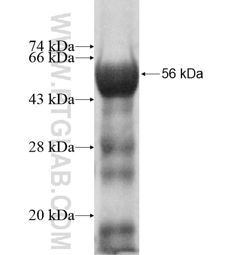 ASTN2 fusion protein Ag11409 SDS-PAGE