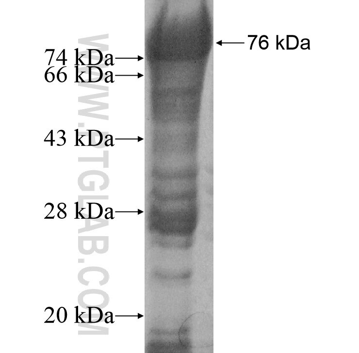 ASTN2 fusion protein Ag11425 SDS-PAGE
