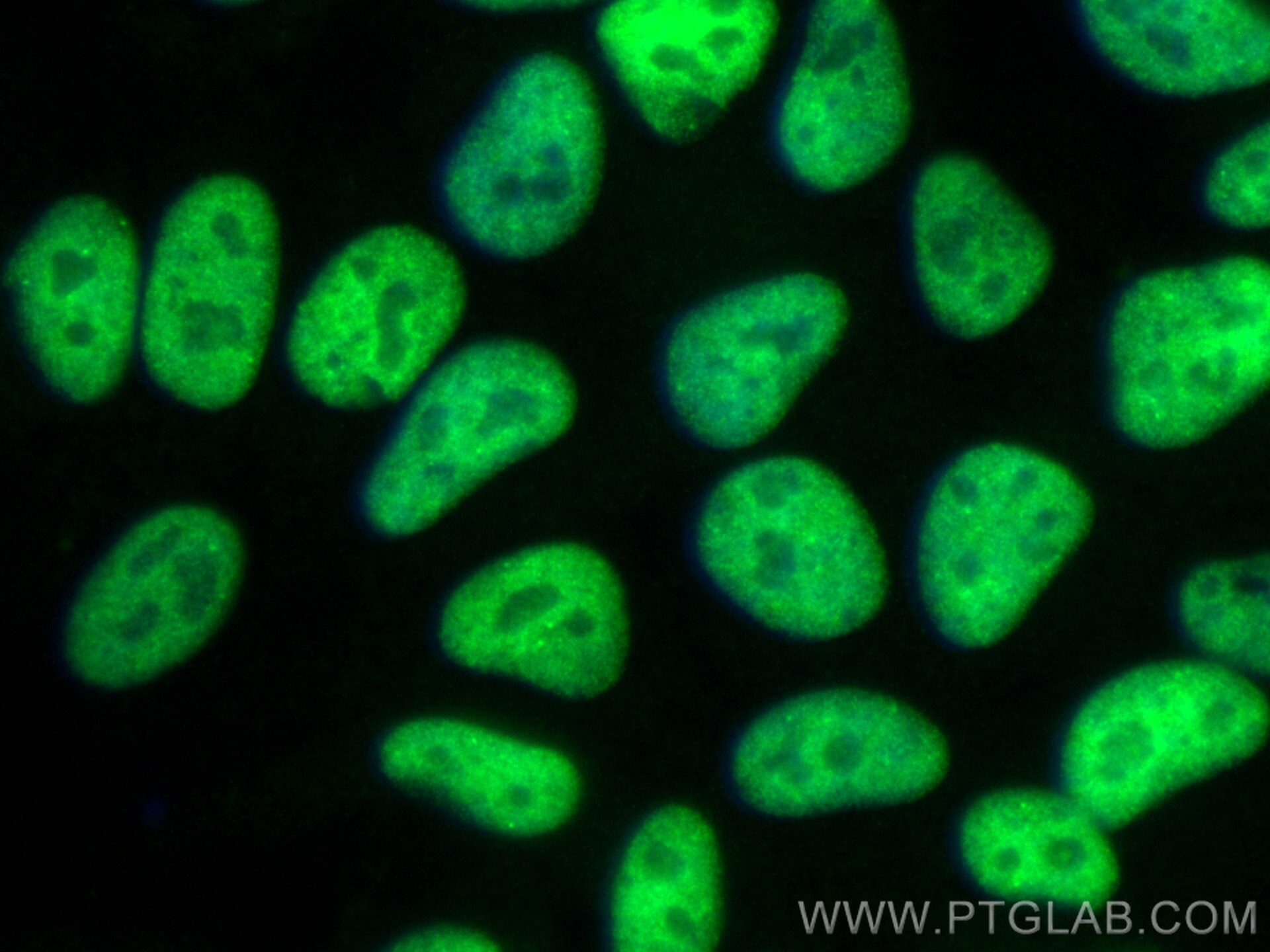 Immunofluorescence (IF) / fluorescent staining of HeLa cells using CoraLite® Plus 488-conjugated ASUN Recombinant ant (CL488-84252-4)