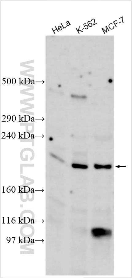 Western Blot (WB) analysis of various lysates using ASXL1 Polyclonal antibody (16803-1-AP)