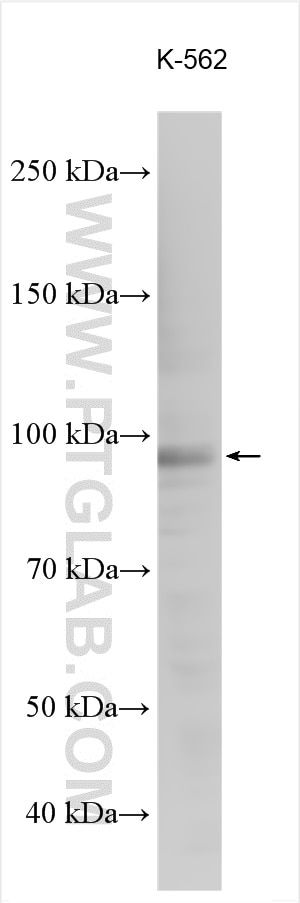 Western Blot (WB) analysis of various lysates using ASXL1 Polyclonal antibody (27042-1-AP)