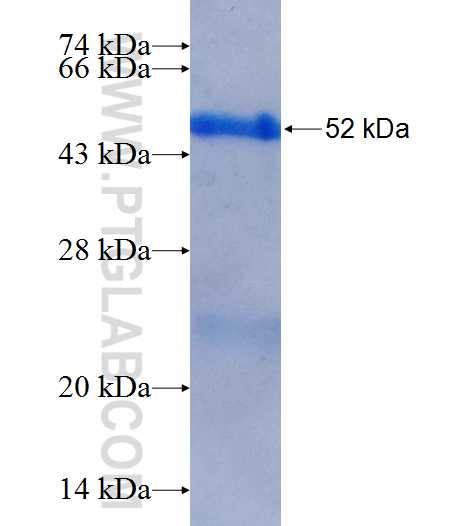 ASXL1 fusion protein Ag25874 SDS-PAGE