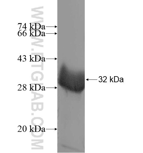 ASXL1 fusion protein Ag10290 SDS-PAGE