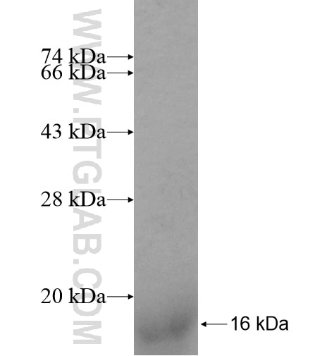 ASXL1 fusion protein Ag10305 SDS-PAGE