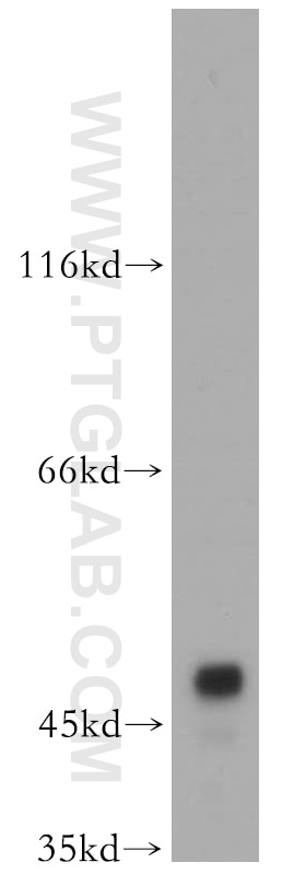 Western Blot (WB) analysis of human testis tissue using ASZ1 Polyclonal antibody (21550-1-AP)