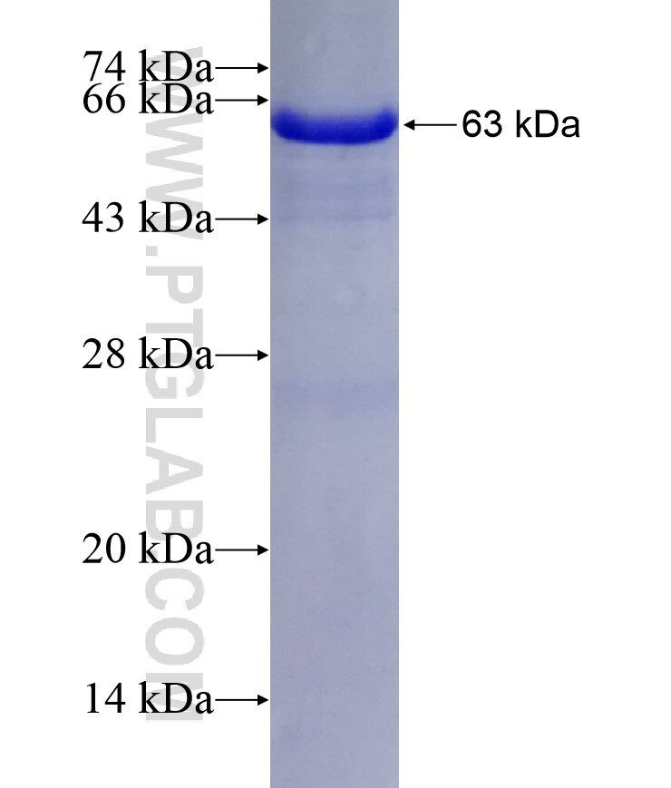 ASZ1 fusion protein Ag16217 SDS-PAGE