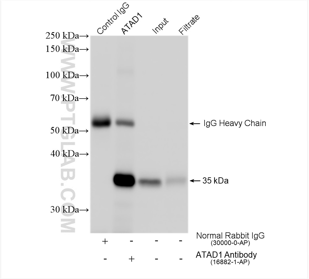 Immunoprecipitation (IP) experiment of mouse brain tissue using ATAD1 Polyclonal antibody (16882-1-AP)
