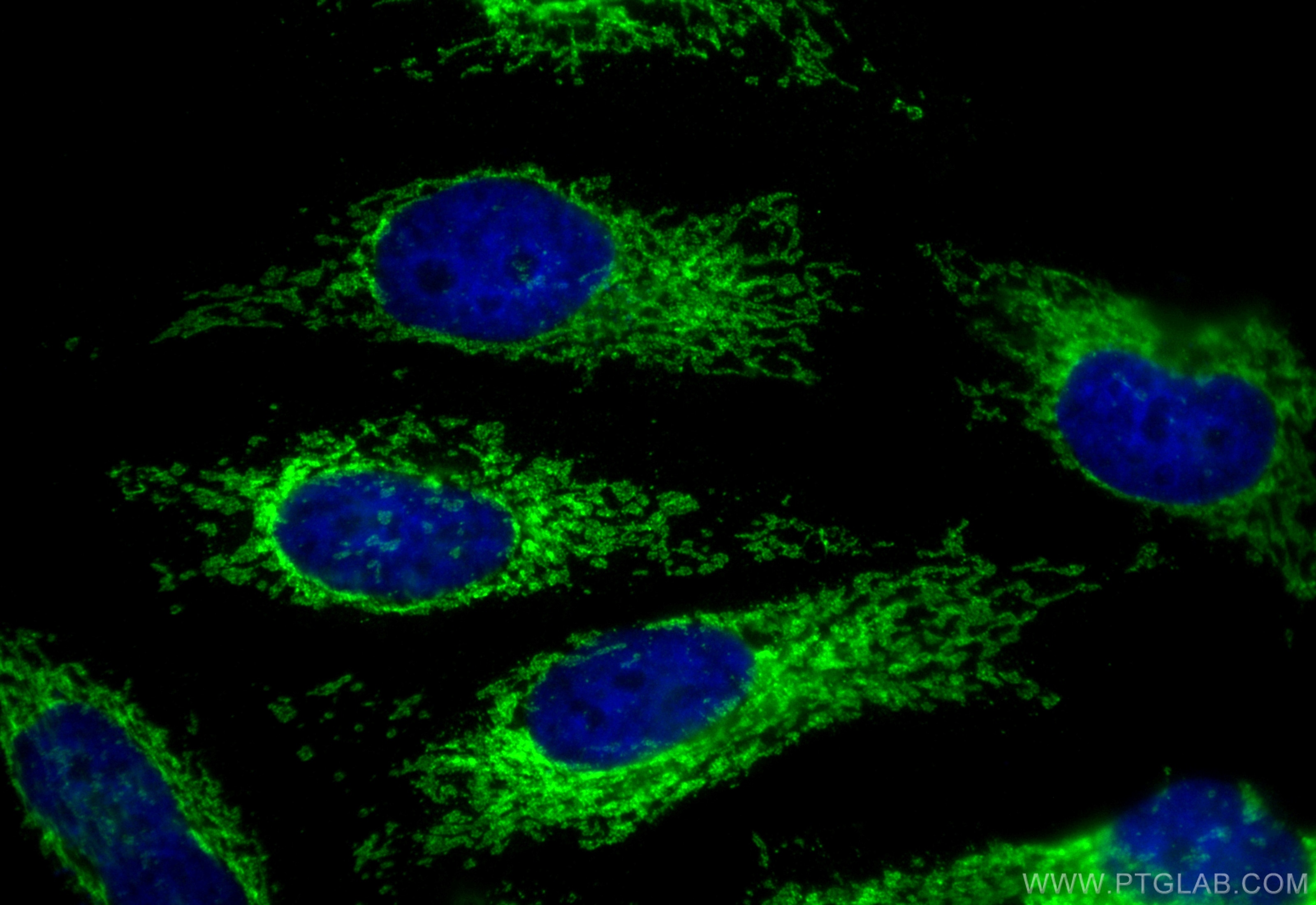Immunofluorescence (IF) / fluorescent staining of HeLa cells using CoraLite® Plus 488-conjugated ATAD1 Recombinant an (CL488-84194-6)