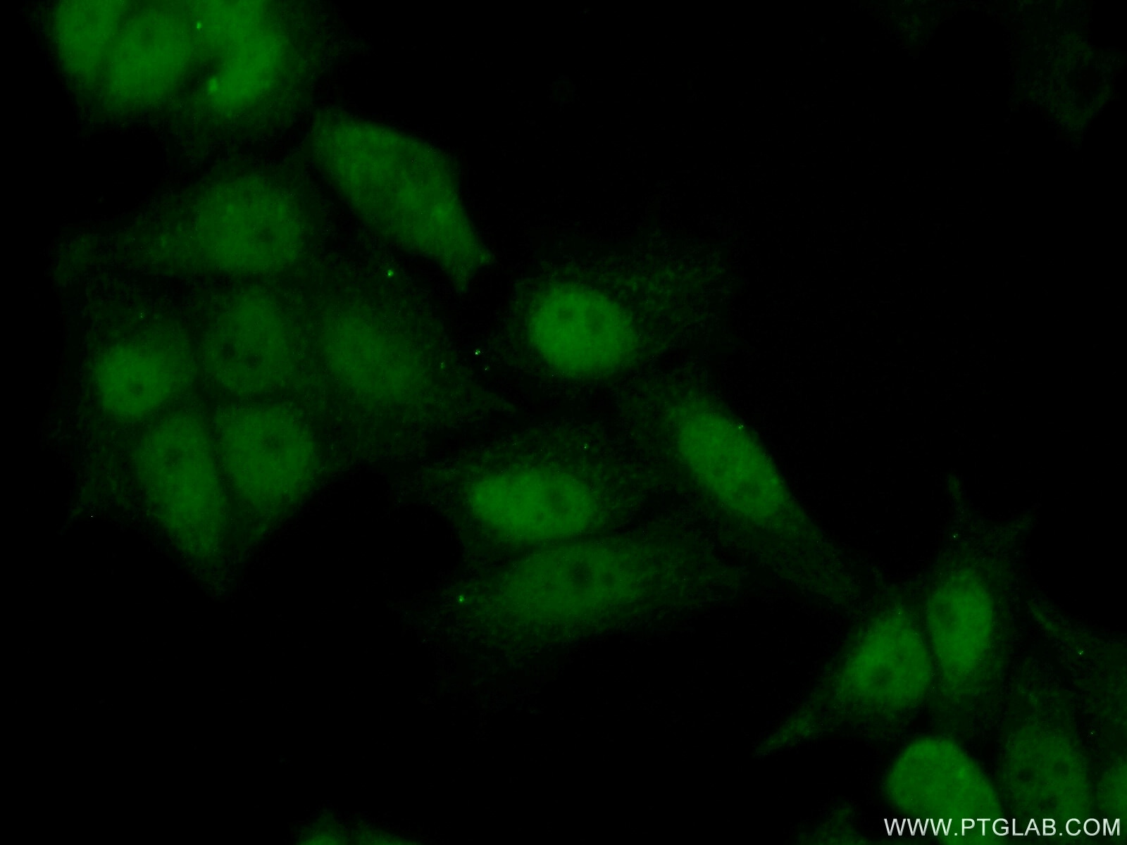 Immunofluorescence (IF) / fluorescent staining of HeLa cells using ATAD2 Polyclonal antibody (23894-1-AP)