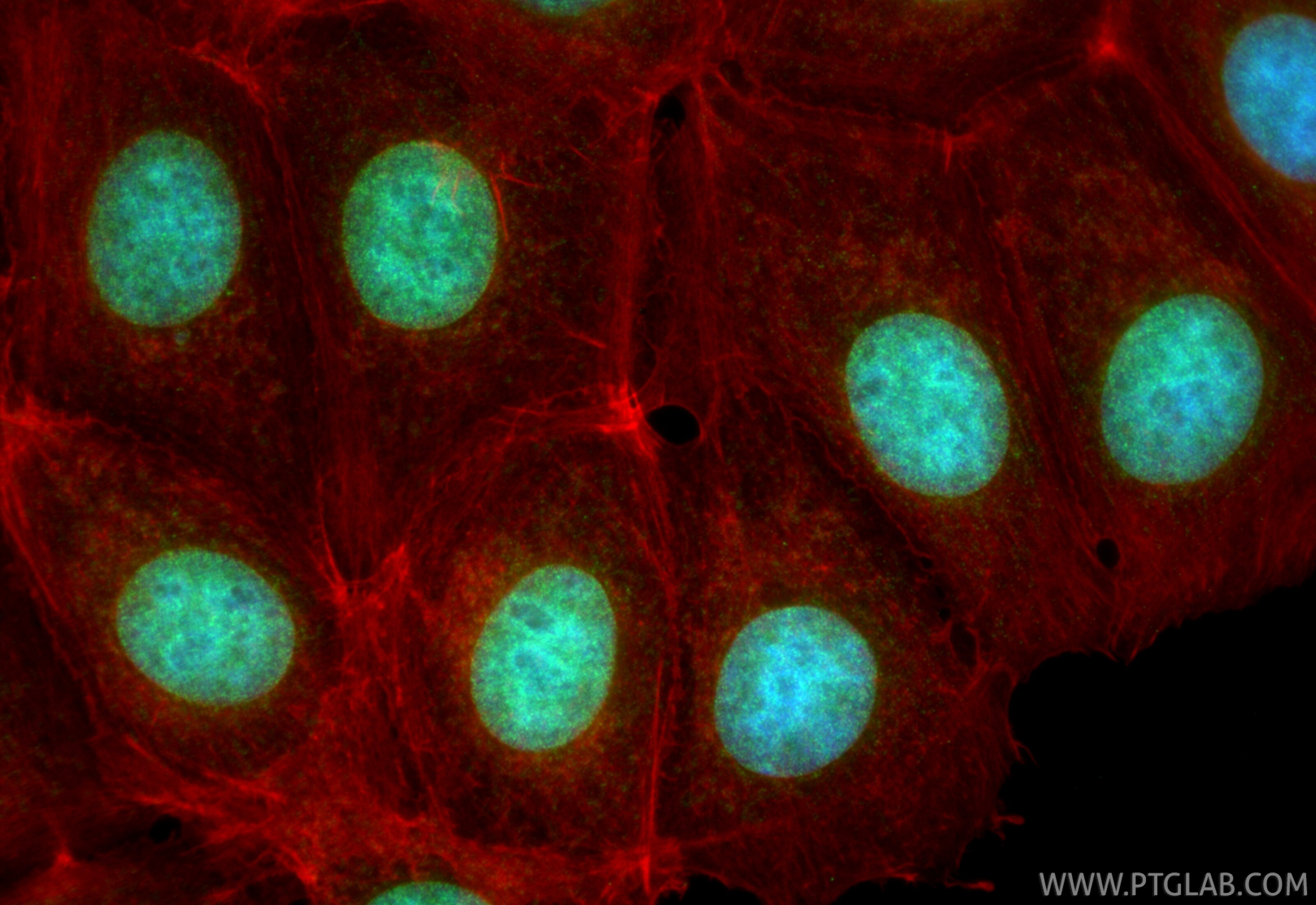 Immunofluorescence (IF) / fluorescent staining of MCF-7 cells using ATAD2 Polyclonal antibody (23894-1-AP)