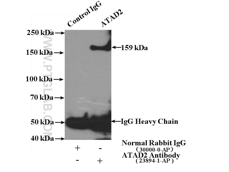 Immunoprecipitation (IP) experiment of HeLa cells using ATAD2 Polyclonal antibody (23894-1-AP)