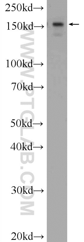 Western Blot (WB) analysis of HeLa cells using ATAD2 Polyclonal antibody (23894-1-AP)