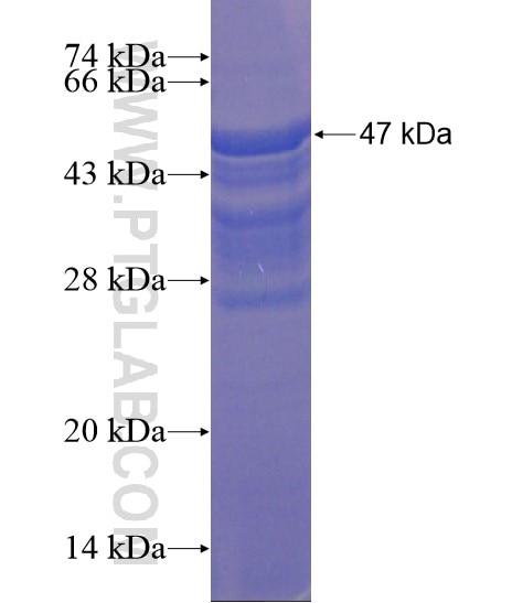 ATAD2 fusion protein Ag20947 SDS-PAGE