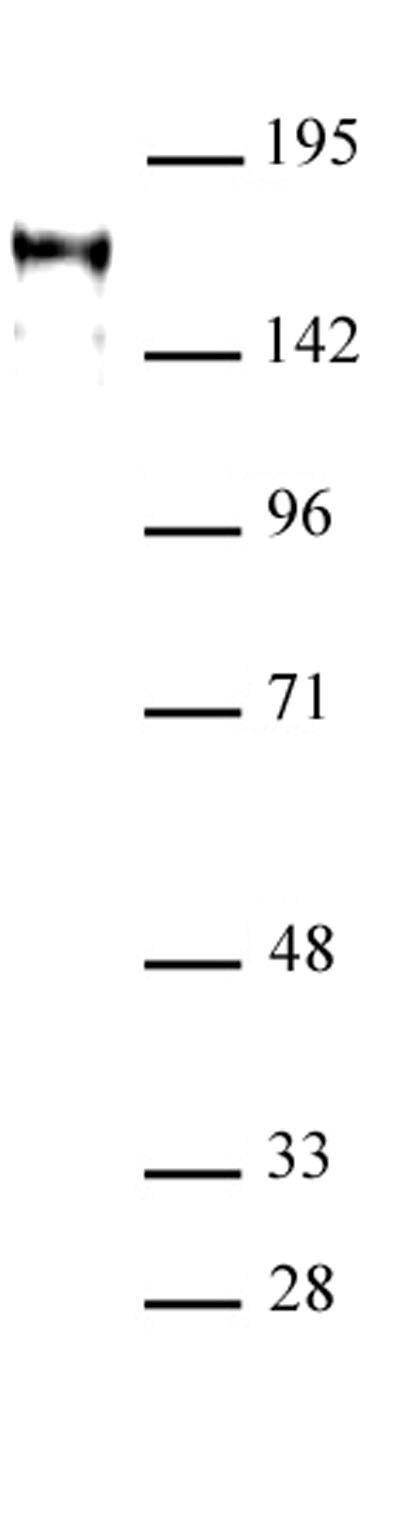 ATAD2 antibody (pAb) tested by Western blot. ATAD2 detection by Western blot. The analysis was performed using 40 ug Jurkat nuclear cell extract and CENP-B at a 1:1,000 dilution.