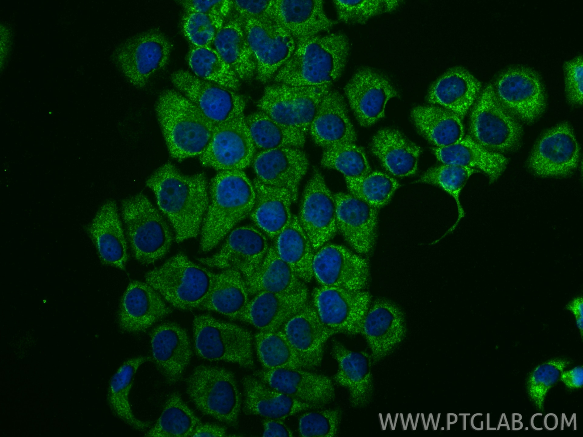Immunofluorescence (IF) / fluorescent staining of NCCIT cells using ATAD3A/B Polyclonal antibody (16610-1-AP)