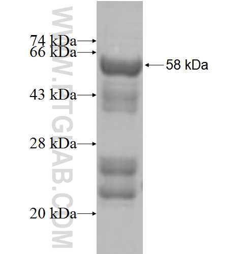 ATAD3B fusion protein Ag9836 SDS-PAGE