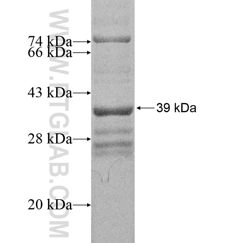 ATAD3C fusion protein Ag16422 SDS-PAGE