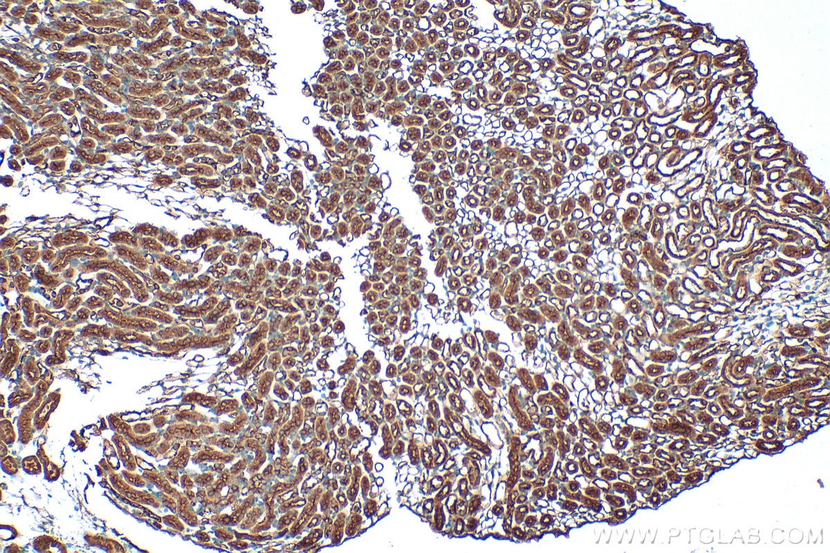 Immunohistochemistry (IHC) staining of mouse kidney tissue using ATAD4 / PRR15L Polyclonal antibody (25693-1-AP)