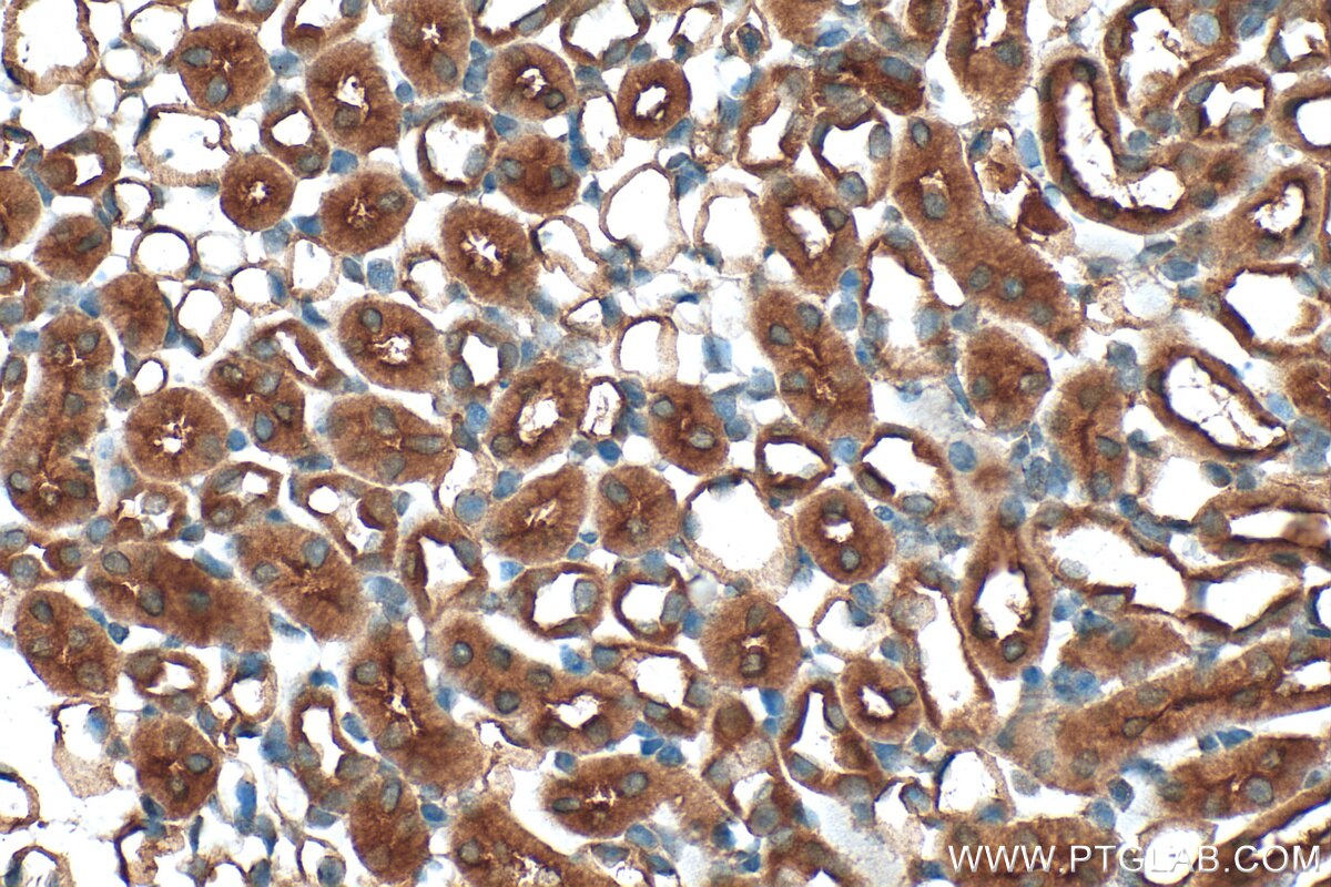 Immunohistochemistry (IHC) staining of mouse kidney tissue using ATAD4 / PRR15L Polyclonal antibody (25693-1-AP)