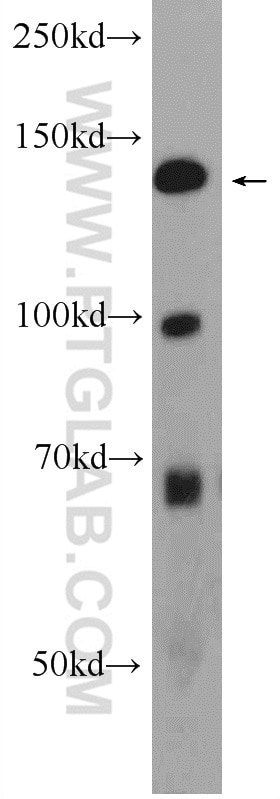 Western Blot (WB) analysis of HeLa cells using ATAD5 Polyclonal antibody (24954-1-AP)