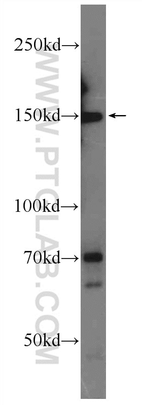 Western Blot (WB) analysis of Jurkat cells using ATAD5 Polyclonal antibody (24954-1-AP)