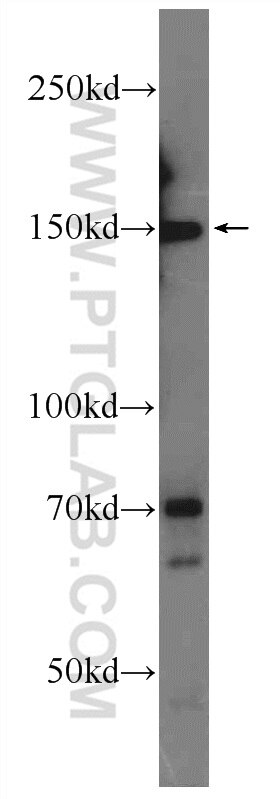 Western Blot (WB) analysis of Jurkat cells using ATAD5 Polyclonal antibody (24954-1-AP)