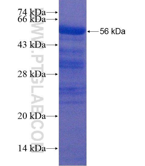 ATAD5 fusion protein Ag20498 SDS-PAGE