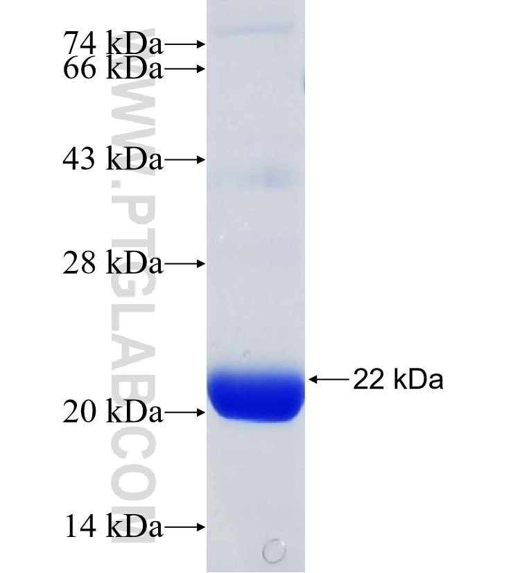 ATAT1 fusion protein Ag31018 SDS-PAGE