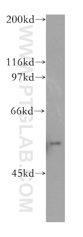 Western Blot (WB) analysis of mouse brain tissue using ATCAY Polyclonal antibody (13257-2-AP)