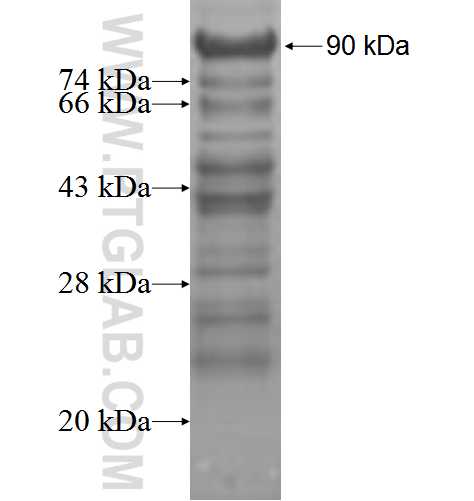 ATCAY fusion protein Ag3658 SDS-PAGE