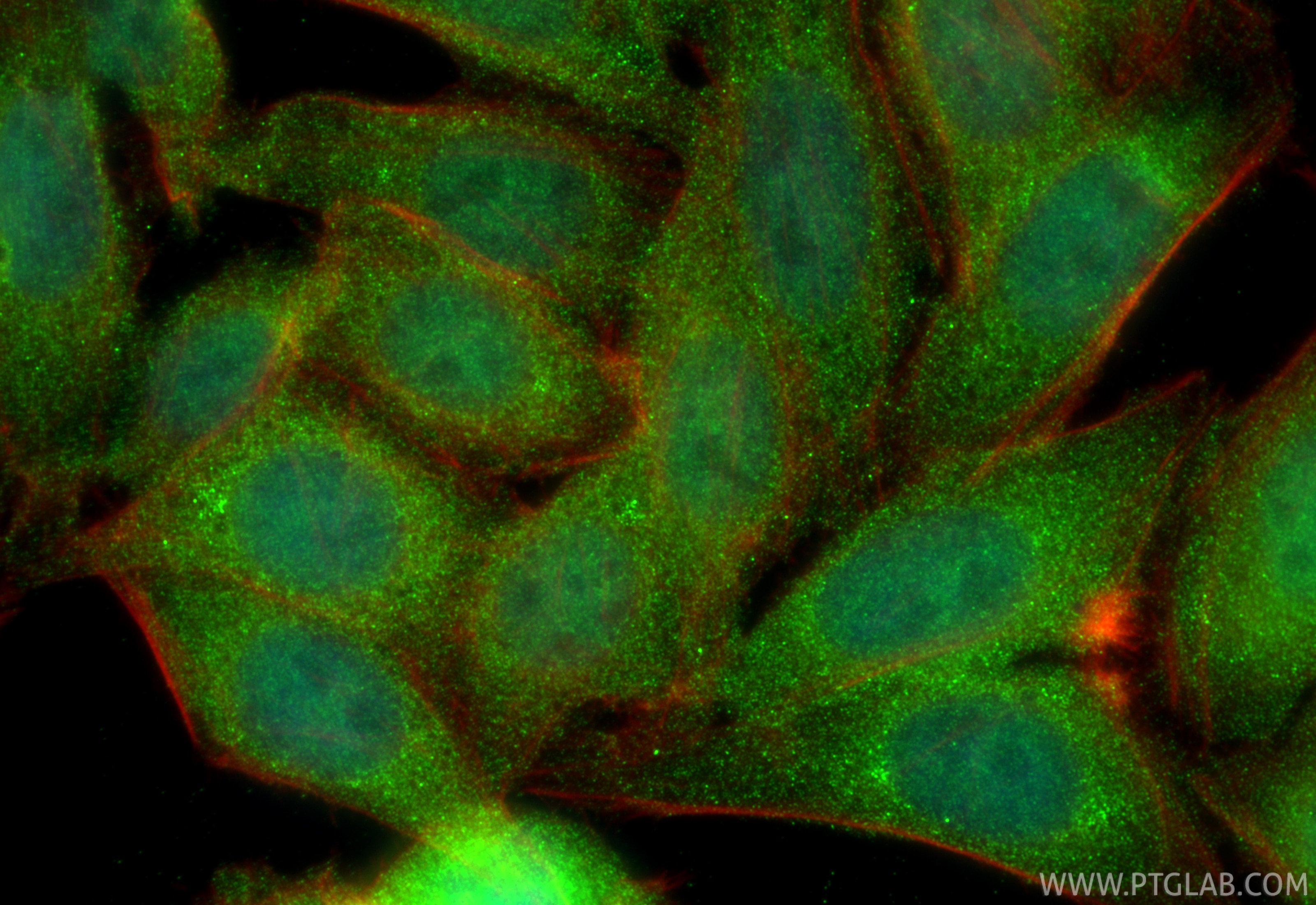 IF Staining of HepG2 using 13973-1-AP Immunofluorescence (IF) / fluorescent staining of HepG2 cells using ATE1 Polyclonal antibody (13973-1-AP)
