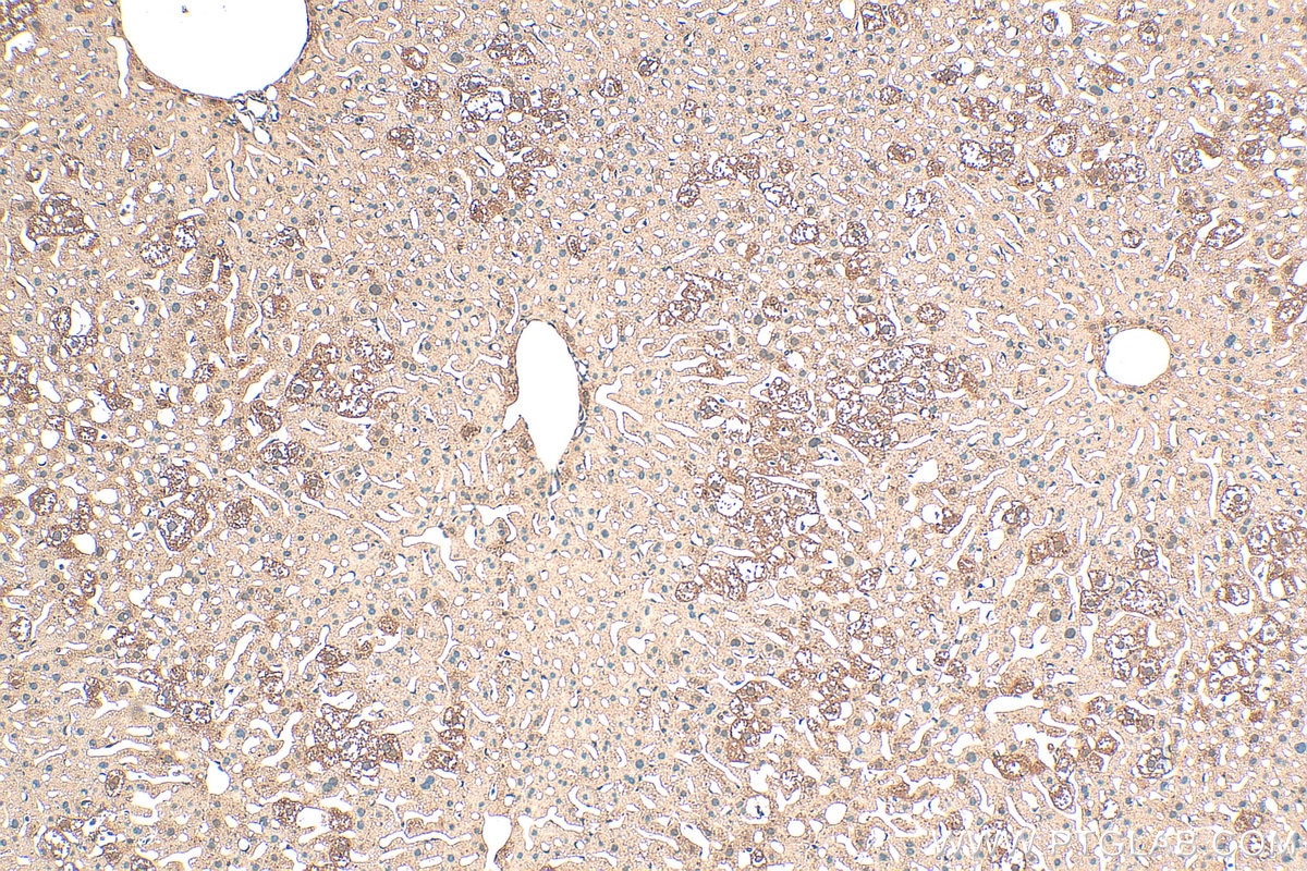 Immunohistochemistry (IHC) staining of mouse liver tissue using ATE1 Polyclonal antibody (13973-1-AP)