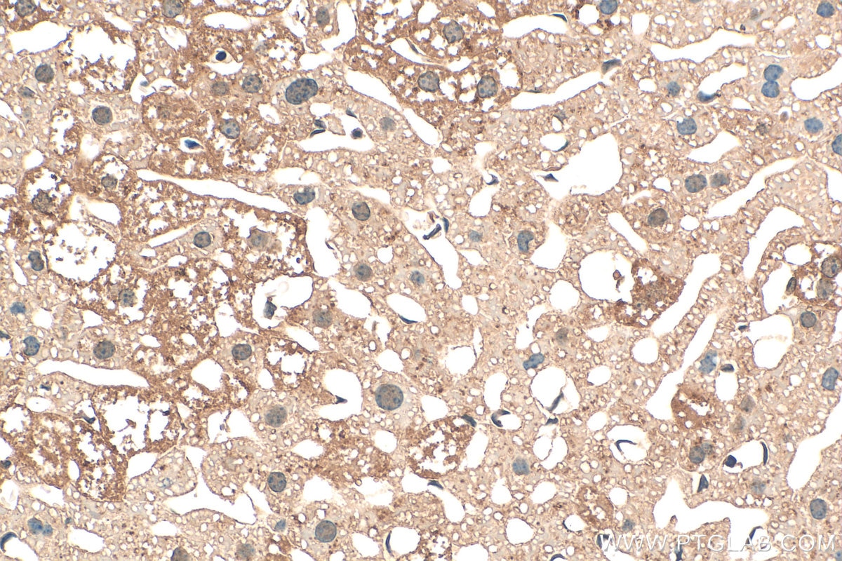 Immunohistochemistry (IHC) staining of mouse liver tissue using ATE1 Polyclonal antibody (13973-1-AP)
