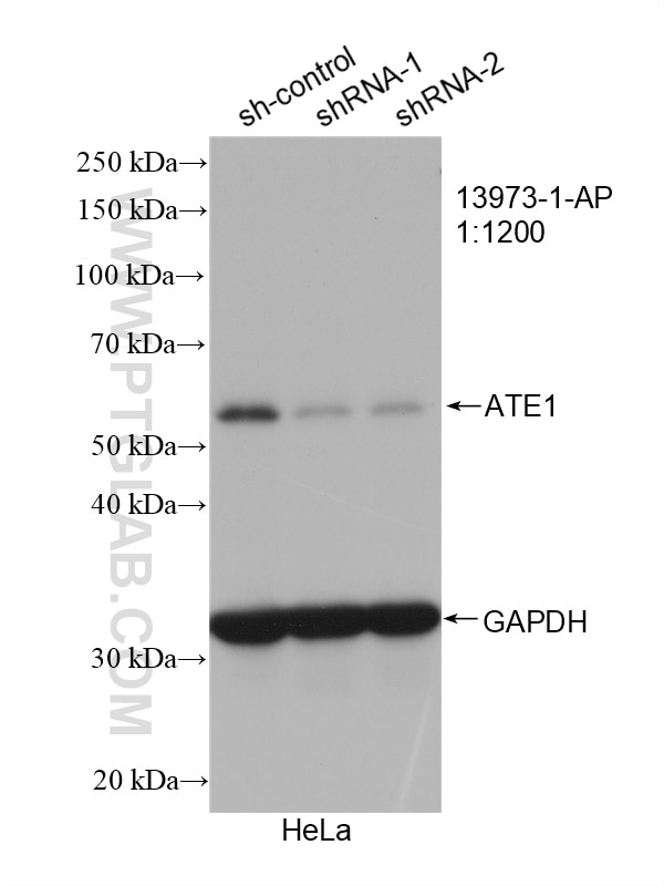 Western Blot (WB) analysis of HeLa cells using ATE1 Polyclonal antibody (13973-1-AP)