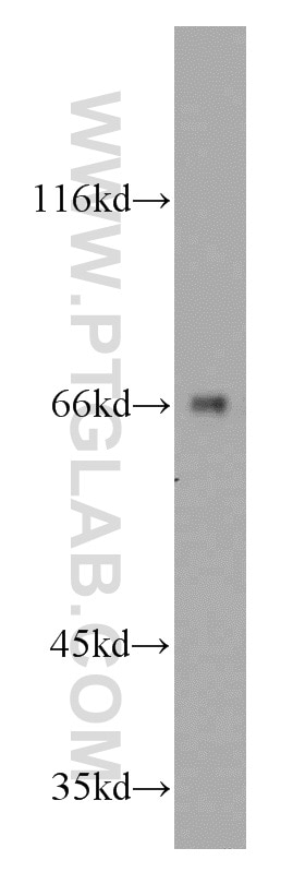 Western Blot (WB) analysis of mouse liver tissue using ATE1 Polyclonal antibody (13973-1-AP)