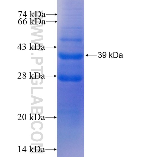 ATE1 fusion protein Ag5156 SDS-PAGE