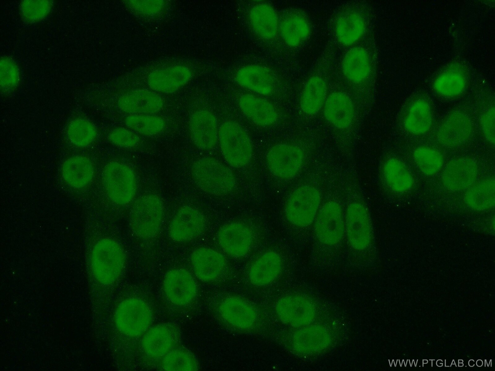 Immunofluorescence (IF) / fluorescent staining of HeLa cells using ATF1 Polyclonal antibody (11946-1-AP)