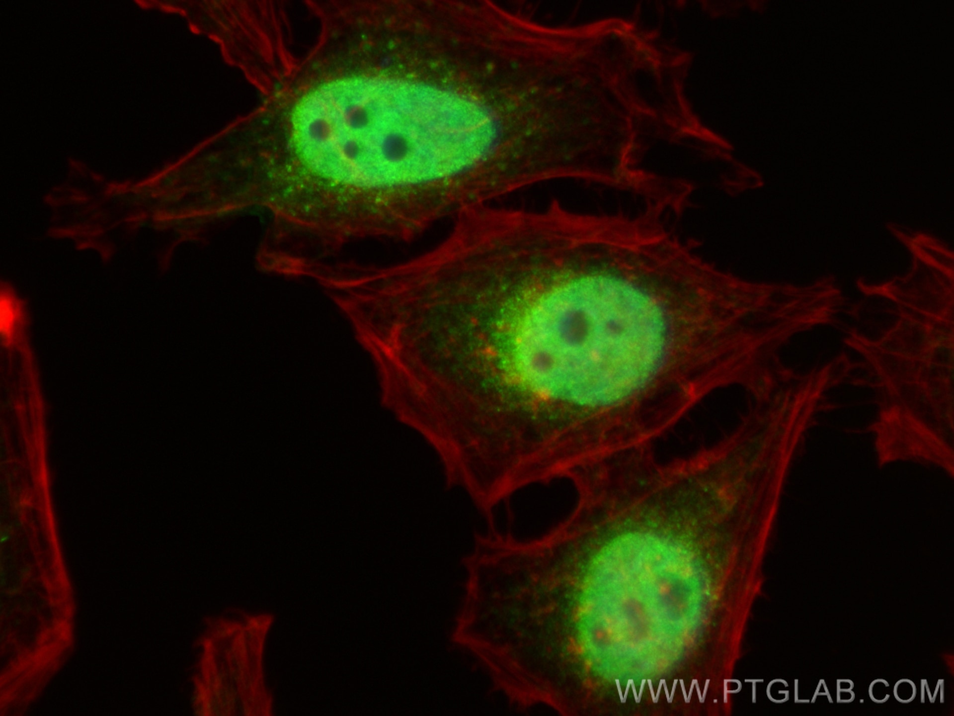 Immunofluorescence (IF) / fluorescent staining of HeLa cells using ATF1 Polyclonal antibody (11946-1-AP)